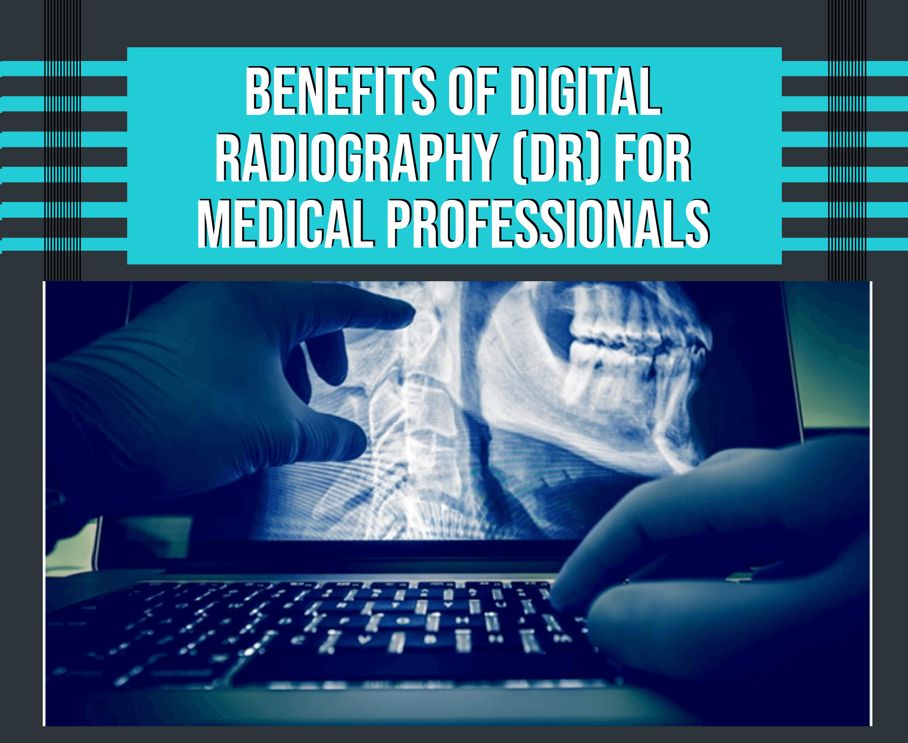 Benefits of Digital Radiography (DR) For Medical Professionals